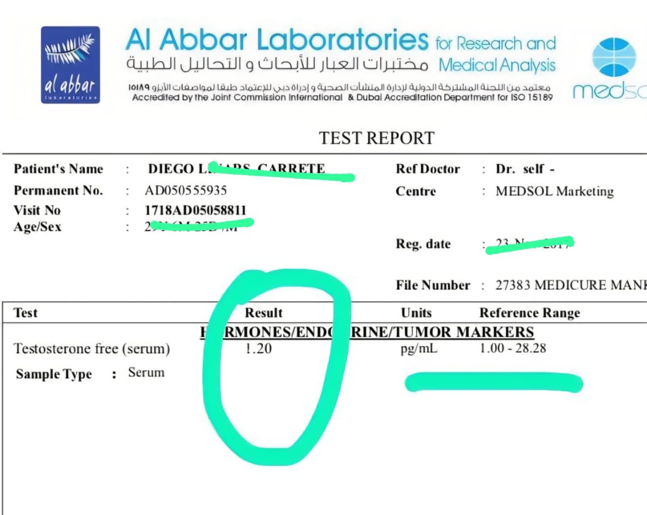 Lab report at age 29
