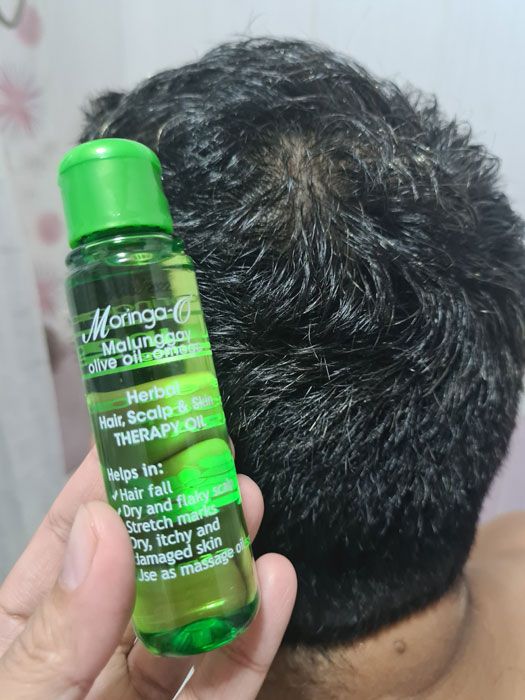MOringa-O2 hair, scalp and skin therapy oil