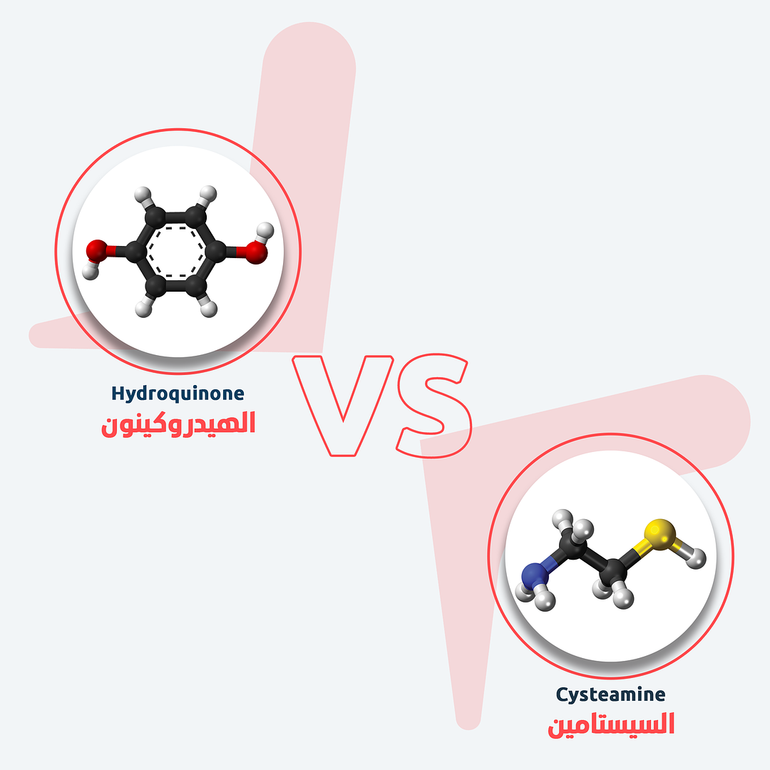 Cysteamine VS Hydroquinone
