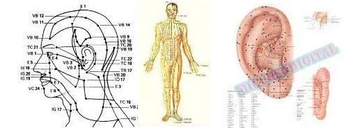 Manipulación de las Agujas en más de 360 puntos del Cuerpo Humano.