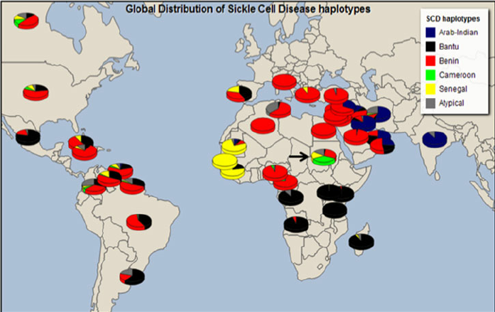 Global-distribution-of-haplotypes-among-various-world-SCD-populations-Previously.png